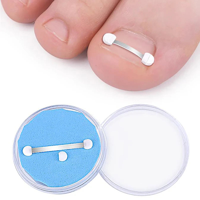 Ingrown Toenail Corrector Tools Pedicure