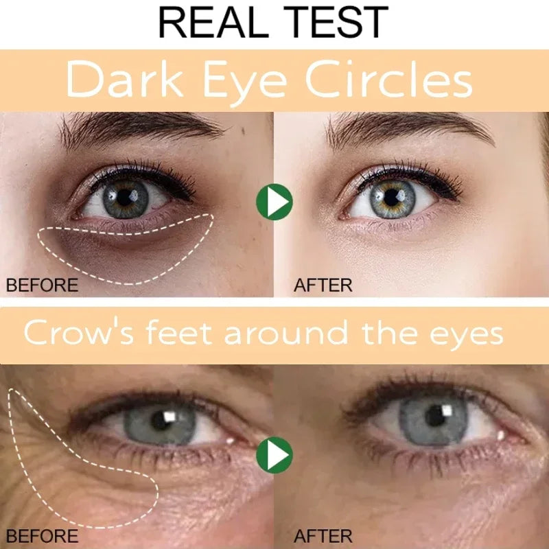 Instant Eye Bag Removal Cream Collagen Removal Wrinkles