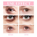 Wrinkle Eye Removing Dark Circles Lightening Fine Lines Moisturizing